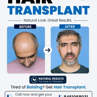 Stop hiding your hair loss.

Start living with confidence again.
A natural-looking hair transplant 