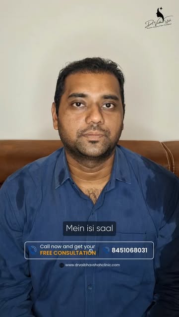 Everyone Started Noticing

The best compliment after a hair transplant?

"You look different... wh