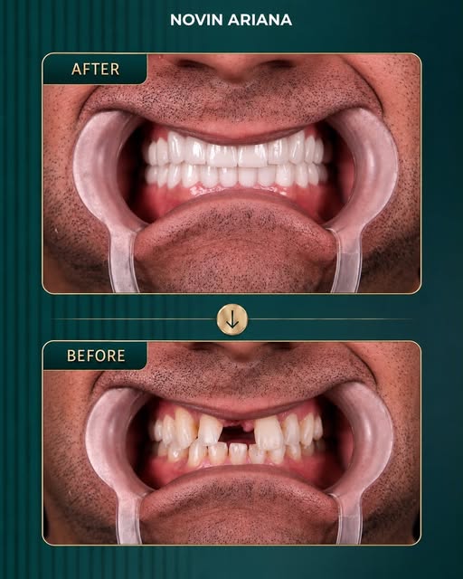 Every smile deserves a treatment plan made for it.
Send us a DM for a consultation and let’s find th