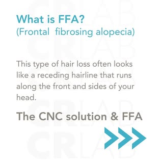 Hair loss looks different for everyone—and so do the solutions. At Greenville Hair & Scalp Solutions