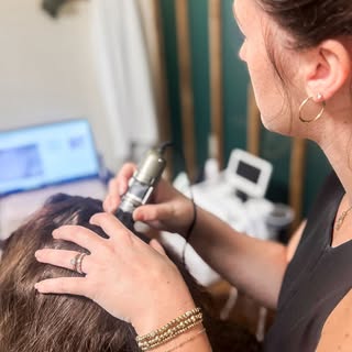 Healthy hair starts at the scalp. ✨

In many cases, addressing the scalp early can help slow or impr