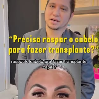 A Gretchen raspou o cabelo para fazer o transplante capilar. Mas será que toda mulher precisa raspar