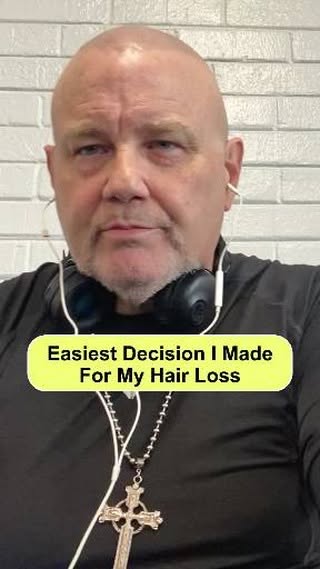 The Easiest Decision I Made For Hair Loss ✈️

"Easiest decision I made for my hair loss..." ✈️ 13 ye
