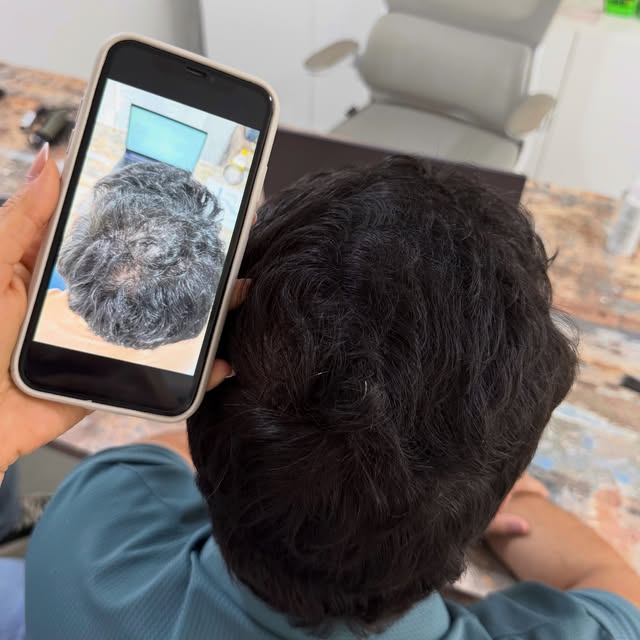 Onde antes havia rarefação, hoje vemos preenchimento. 

A evolução acontece quando a calvície é cuid