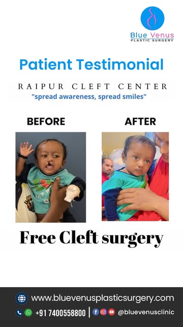 🤍 हर बच्चे की cleft journey अलग होती है।

इस patient testimonial में देखिए एक baby की Cleft Lip Tre