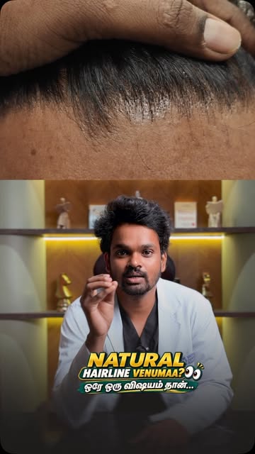 Natural hairline venumaa? 👀

Hair transplant-la **hairline design** thaan natural look-ku key! ✅
**
