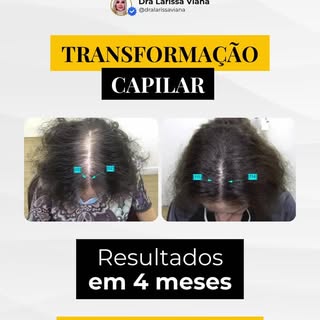 Quatro meses podem mostrar uma mudança que vai muito além dos fios.

Quando existe indicação correta