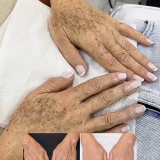 Manchas, textura irregular e sinais do tempo também aparecem nas mãos — uma região que merece tanta 
