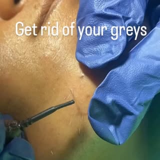 Grey facial hair? Not anymore. ✨
Smooth skin. Enhanced confidence. Beautiful results.
📍Book your co