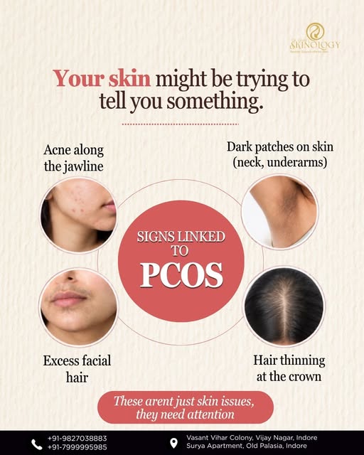 Your skin can sometimes reveal signs beyond skincare especially  when PCOS may be involved. 🩺✨

Jaw