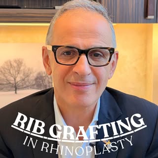 Cartilage grafts play an important role in many rhinoplasty procedures. Dr. Khosh explains when they