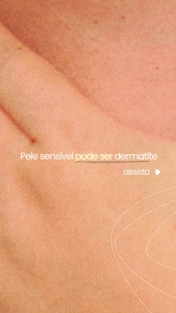 Pele que arde, coça, fica vermelha ou descama com frequência merece atenção.

Nem sempre trocar o pr