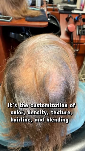 This is what a custom hair system looks like.
Every system is made specifically for your scalp using