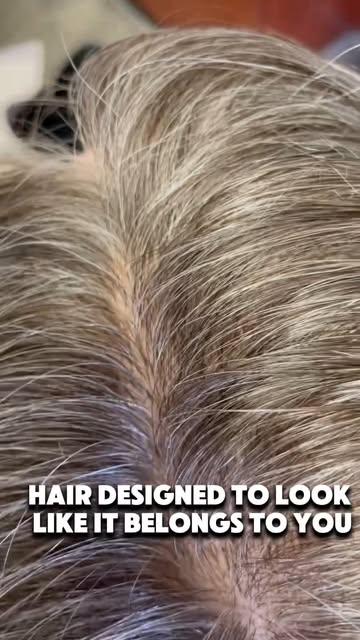 This is what a custom hair system looks like.
Every system is made specifically for your scalp using