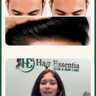 Feeling unconfident because of hair loss or looking older than your age? Don't worry!
With Hair Tran