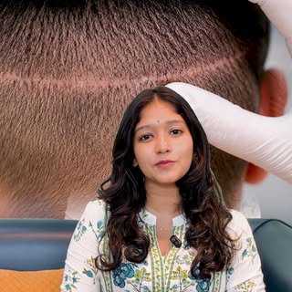Vizag:9154806679
Say goodbye to hair transplant doubts! 💇‍♂️✨

Worried about pain, scars, or unnatu