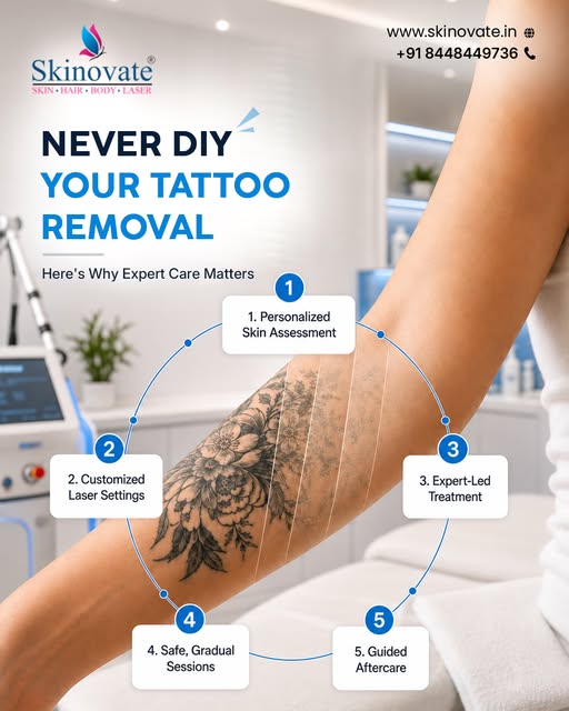 Never DIY Your Tattoo Removal! ✨

Tattoo removal needs expert care, advanced laser technology, and a