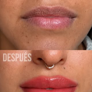 Aclaramiento de labios oscuros.