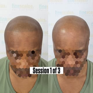 A more subtle shape up smp to frame the face and create the appearance of a shaved hair look.  Even 