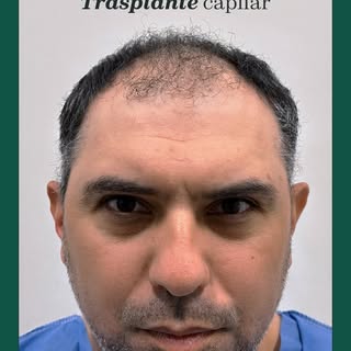 Restauración capilar, a cargo de un experto 😎
Compartimos otro caso de éxito de uno de nuestros pac