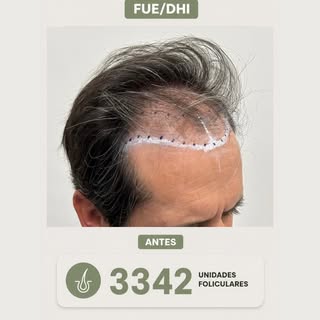 No se trata solo de cabello, sino de cómo te sientes contigo mismo. 😉

📲 81 1169 9100
📍San Pedro 
