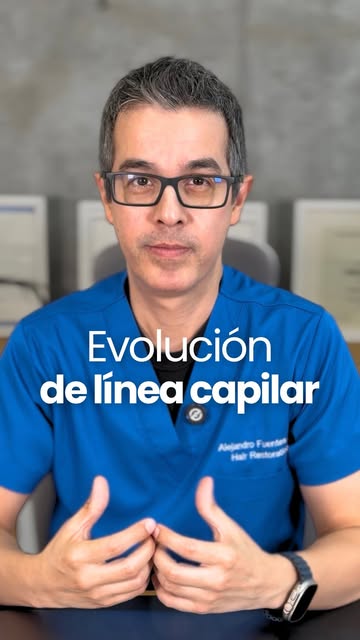 Una buena línea frontal no se diseña pensando únicamente en el resultado inmediato, sino en cómo evo