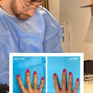בטיפול הננופט ניתן להשתמש בשומן שלנו גם לטיפולי גוף, והפעם, טיפול משולב של שיער עם כפות ידיים. כפות 