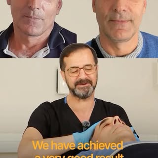 Dr. Ertuğrul explains the real impact of PRP — and the results speak for themselves.

At 6 months, t