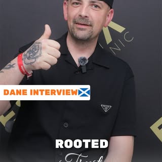 🏴󠁧󠁢󠁳󠁣󠁴󠁿 From Scotland to Antalya: Dane’s Hair Transplant Journey!🚀
We are thrilled to share 