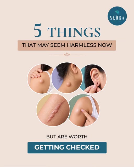 Some skin concerns are easy to ignore simply because they’ve been there for years.
Swipe to see whic