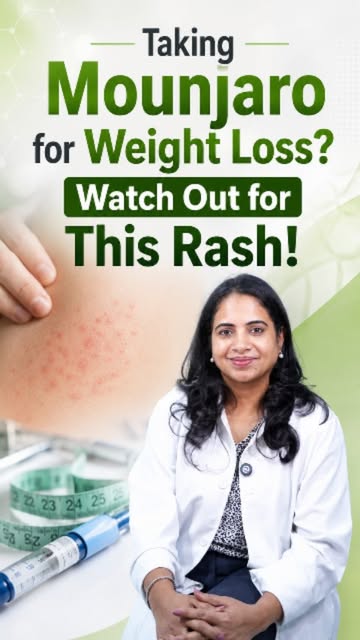 💉 **Taking Mounjaro for Weight Loss? Watch Out for Skin Rashes!** ⚠️

Mounjaro (tirzepatide) is use