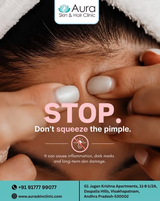 🛑 STOP. Don’t Squeeze the Pimple! 😊 

Hey beautiful skin warriors! 💆‍♀️ That little pimple is tem