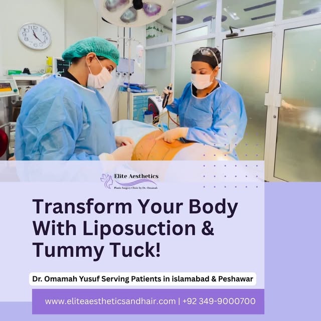 Target stubborn fat with advanced liposuction treatments including:
• Tummy Liposuction
• Double Chi