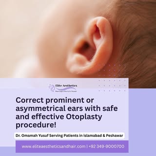 Correct prominent or asymmetrical ears with safe and effective Otoplasty surgery by Dr. Omamah Yusuf