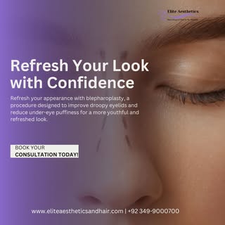 Refresh your appearance with blepharoplasty, a procedure designed to improve droopy eyelids and redu