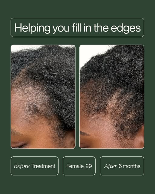 We're here to help you regain your edges *and* your confidence. 🌱⁠
⁠
Come in for a free consultatio