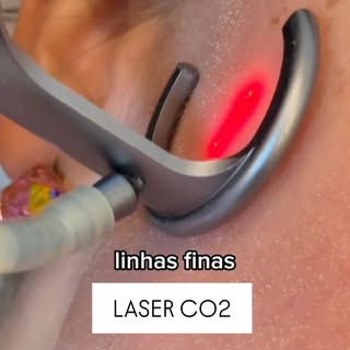 O melhor momento para fazer Laser de CO₂ não é no verão. 
É agora.

Menos exposição solar, recuperaç
