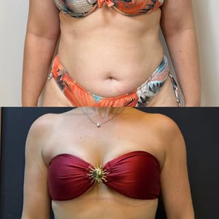 Do tamanho 48 ao 38... sem flacidez! ✨

Esse foi o resultado incrível da nossa paciente. Mais do que