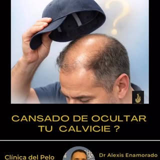 Clínica del Pelo Chile.
Aquí te ayudaremos a recuperar el pelo caído , te recomendamos el tratamient