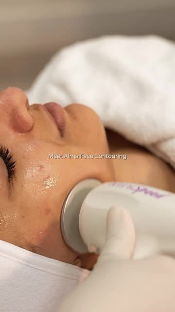 Want a more defined, sculpted look without anything invasive?

Alma Face Contouring is designed to h
