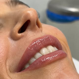 ¿Quieres unos labios más hidratados y definidos, pero con un resultado natural? ✨

Agenda tu cita en
