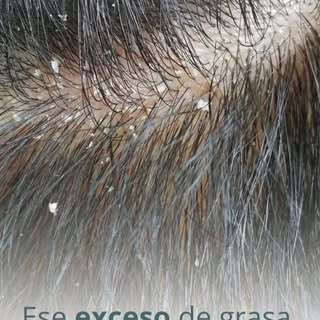¿Qué nos dice el cuero cabelludo sobre nuestra salud? 💆‍♂️✨

Tu cuero cabelludo habla, ¡y es moment