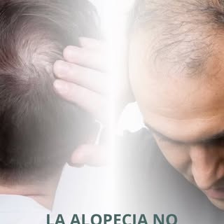 La alopecia no siempre requiere el mismo tratamiento 🧠🔍

¿Por qué? 🤔

Porque la alopecia no se ve