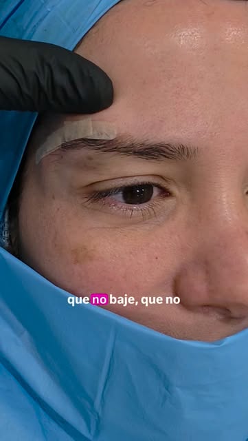 Regresamos de vacaciones haciendo lo que nos apasiona: rejuvenecer la mirada. 

#LiftingDeCeja #Ceja