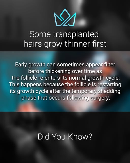 When transplanted follicles begin producing hair again, the first strands can sometimes appear finer