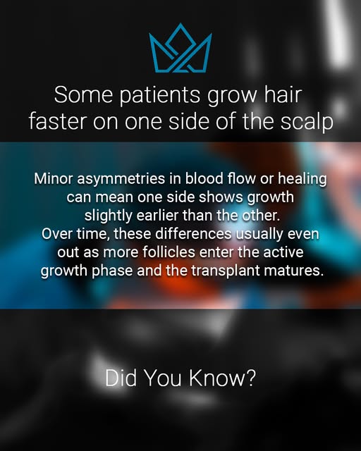 It is not uncommon for patients to notice that one side of the transplant seems to grow slightly fas