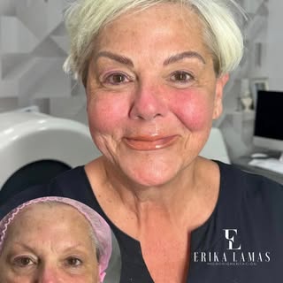 Nanobrows technique offers the convenience of flawless beauty that lasts, enhancing confidence and s