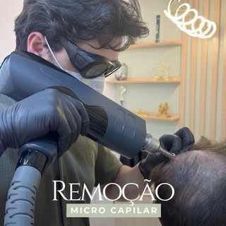 Remoção de micropigmentação capilar mal feita! ✨
Você não precisa ficar com algo que não te faz feli