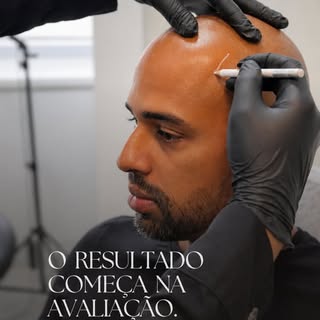 Você não precisa apenas de uma nanopigmentação. Precisa de uma nanopigmentação capilar que faça sent