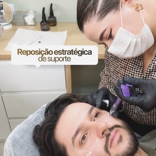 Preenchimento malar no marido também vale como demonstração prática 😂💉 
💍 @alexxalaga.microcapila
